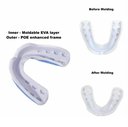Ergo Fusion Mouthguard